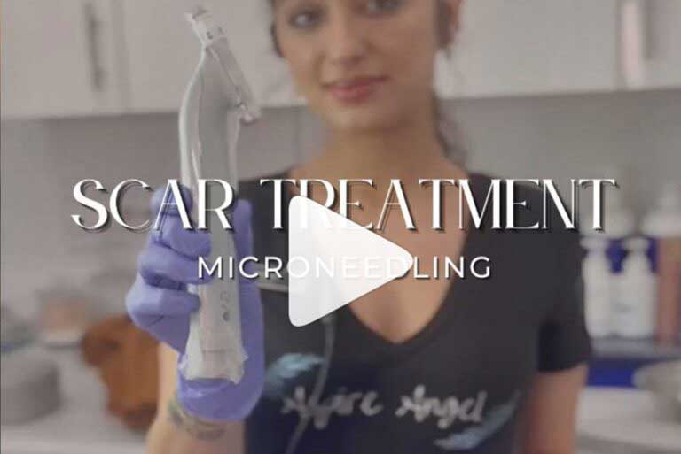 Before and After Images of Aspire MedSpa & Beauty Bar in Tampa, FL