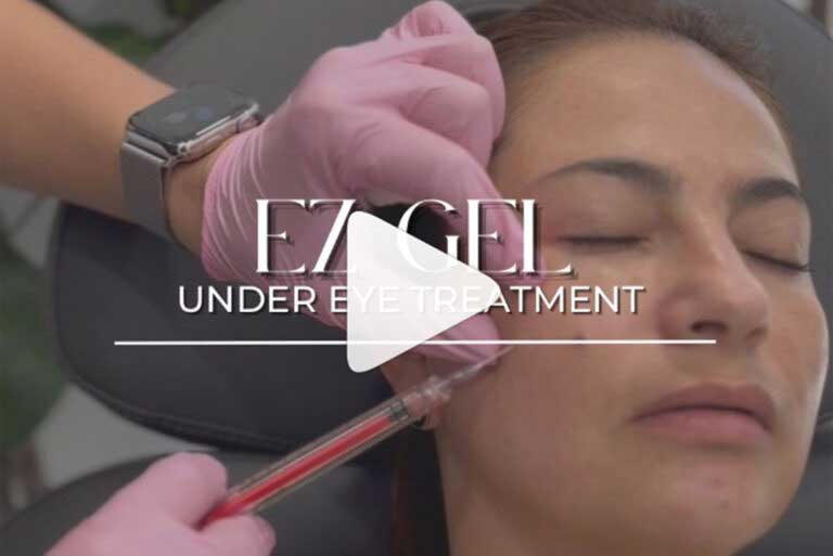 Before and After Images of Aspire MedSpa & Beauty Bar in Tampa, FL