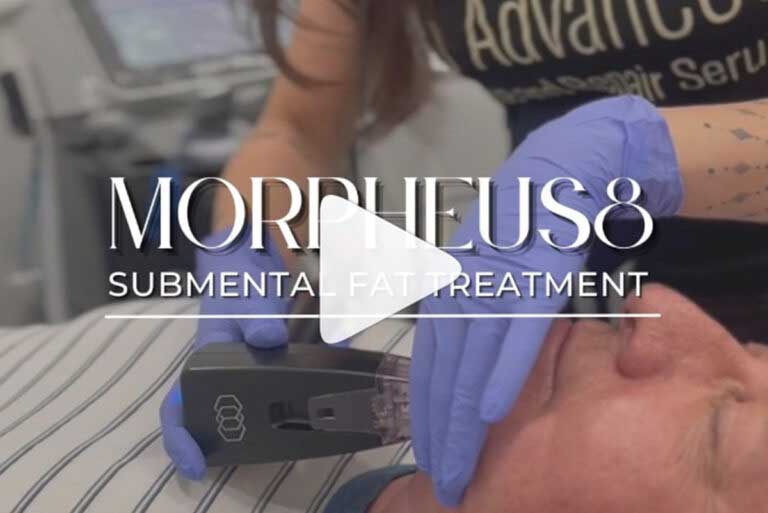 Before and After Images of Aspire MedSpa & Beauty Bar in Tampa, FL