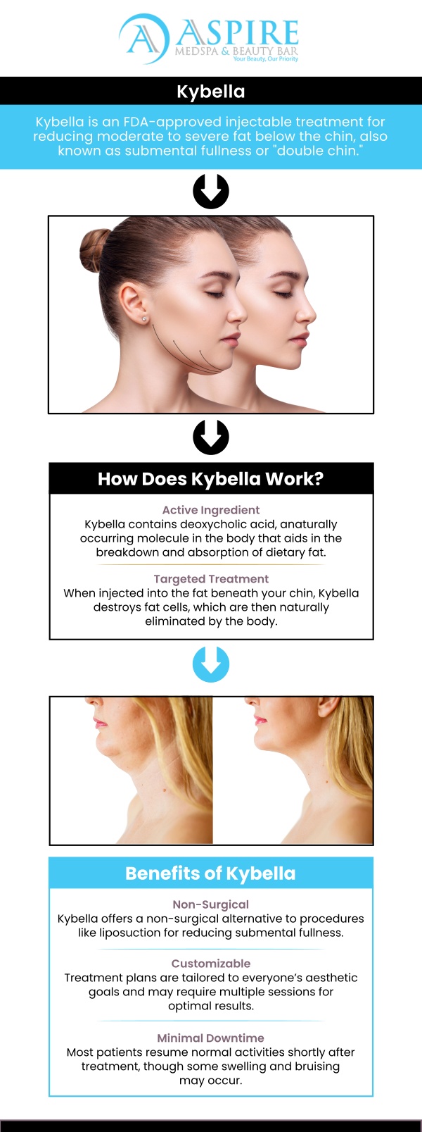 Kybella is an FDA-approved injectable treatment designed to reduce submental fat, commonly known as a double chin. The active ingredient, deoxycholic acid, targets and breaks down fat cells, leading to a more contoured and defined jawline. Visit our team to experience exceptional care and personalized treatments. For more information, contact us or schedule an appointment online. We are conveniently located at 12932 N Dale Mabry Hwy, Tampa, FL 33618.