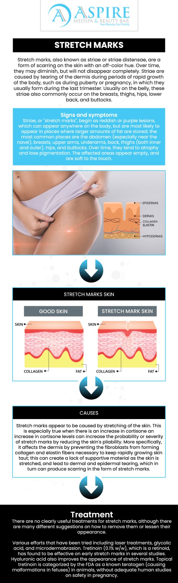 Common questions asked by clients: What causes stretch marks and how can they be prevented? Are there any effective treatments to reduce the appearance of stretch marks? Can stretch marks be completely removed with treatments? How long does it take to see results from treatments for stretch marks? For more information, contact us or schedule an appointment online. We are conveniently located at 12932 N Dale Mabry Hwy, Tampa, FL 33618. We serve clients from Tampa FL, Egypt Lake-Leto FL, Town ‘n’ Country FL, Westchase FL, Temple Terrace FL, Lutz FL, Oldsmar FL, Keystone FL, Wesley Chapel FL, and surrounding areas.