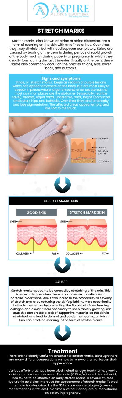 Common questions asked by clients: What causes stretch marks and how can they be prevented? Are there any effective treatments to reduce the appearance of stretch marks? Can stretch marks be completely removed with treatments? How long does it take to see results from treatments for stretch marks? For more information, contact us or schedule an appointment online. We are conveniently located at 12932 N Dale Mabry Hwy, Tampa, FL 33618. We serve clients from Tampa FL, Egypt Lake-Leto FL, Town ‘n’ Country FL, Westchase FL, Temple Terrace FL, Lutz FL, Oldsmar FL, Keystone FL, Wesley Chapel FL, and surrounding areas.